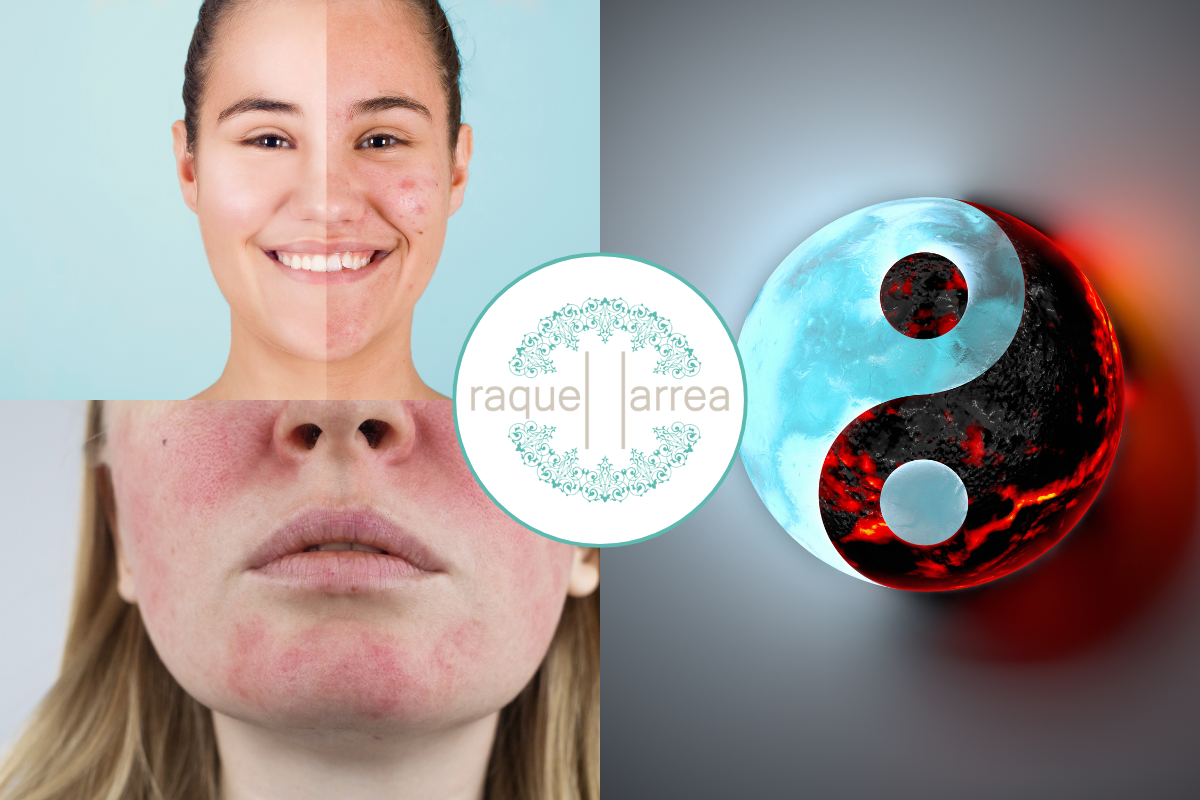 Práctica de acupuntura facial avanzada en la Escuela Raquel Larrea
