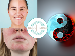 curso avanzado acupuntura